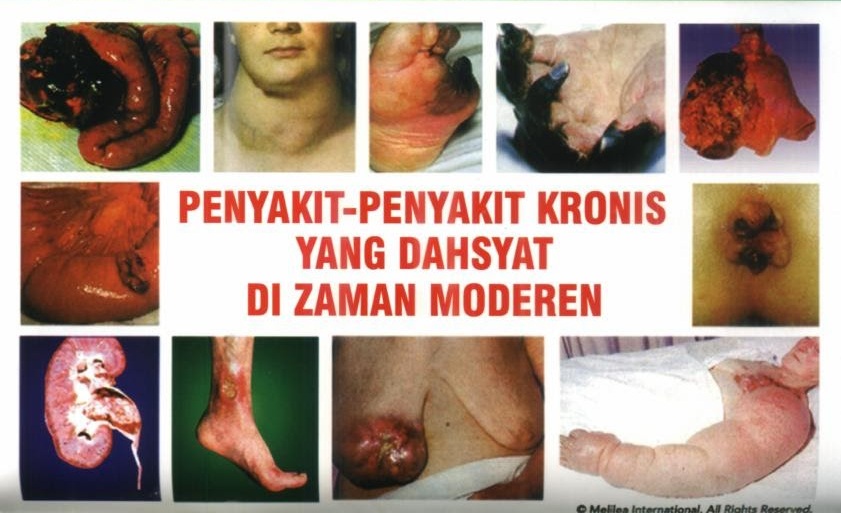 penyakit kronis